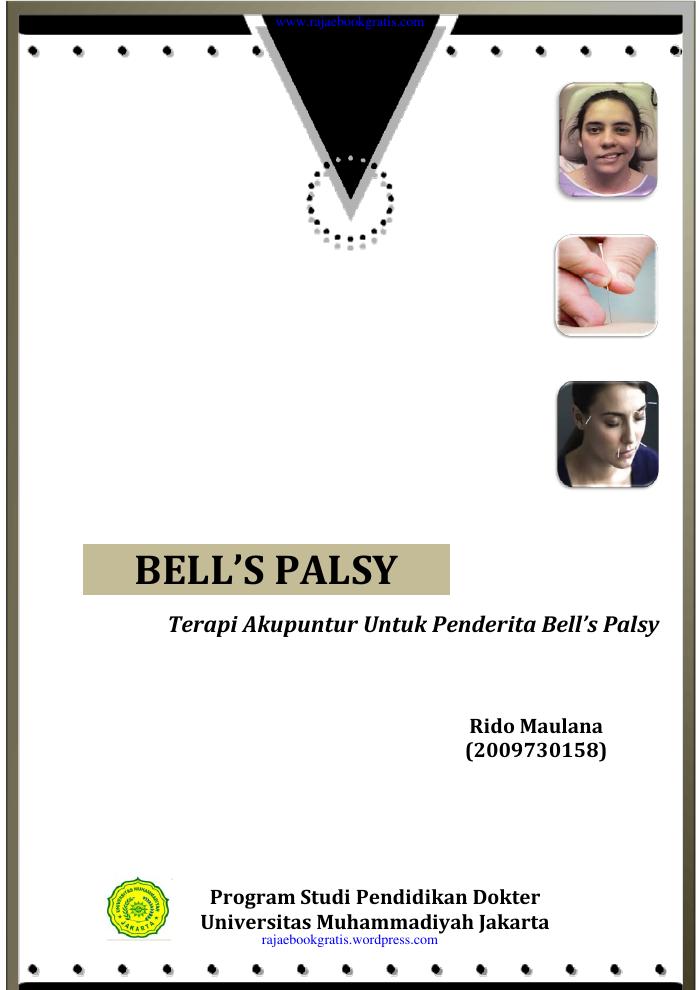 Terapi Akupuntur untuk Bells Palsy